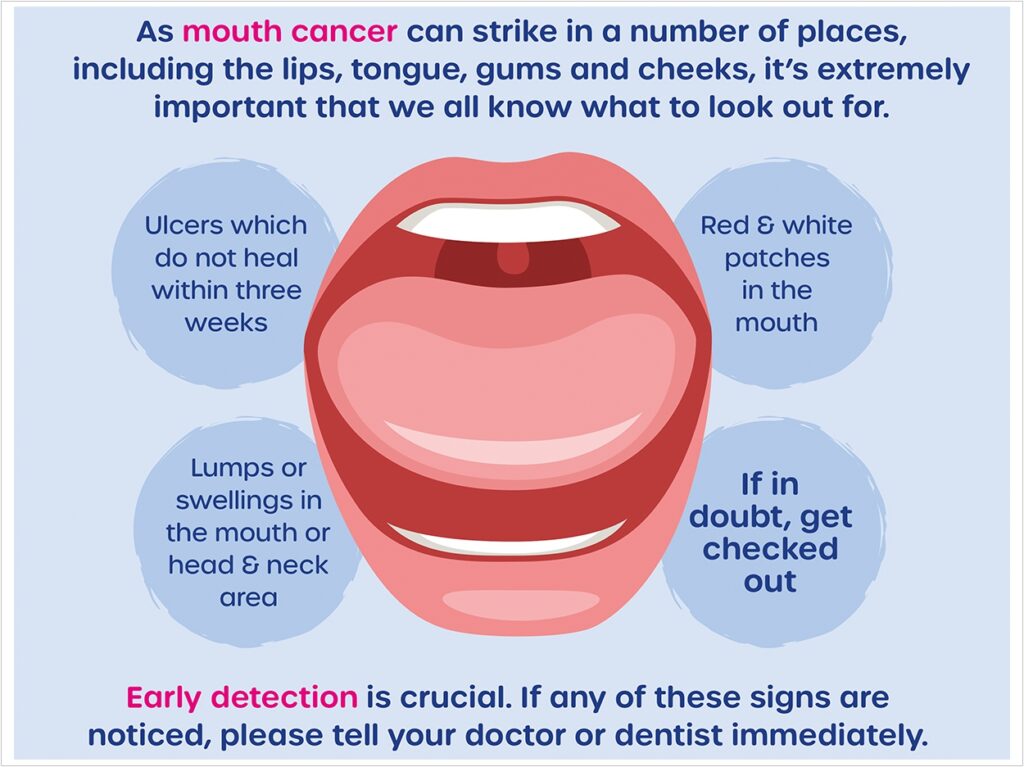Mouth cancer warning signs: ulcers that do not heal, red and white patches, and lumps or swellings