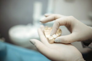 Dental technician holding a model of teeth